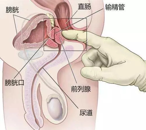 真的有前列腺高潮吗 有没有成功过 什么感觉 性说问答