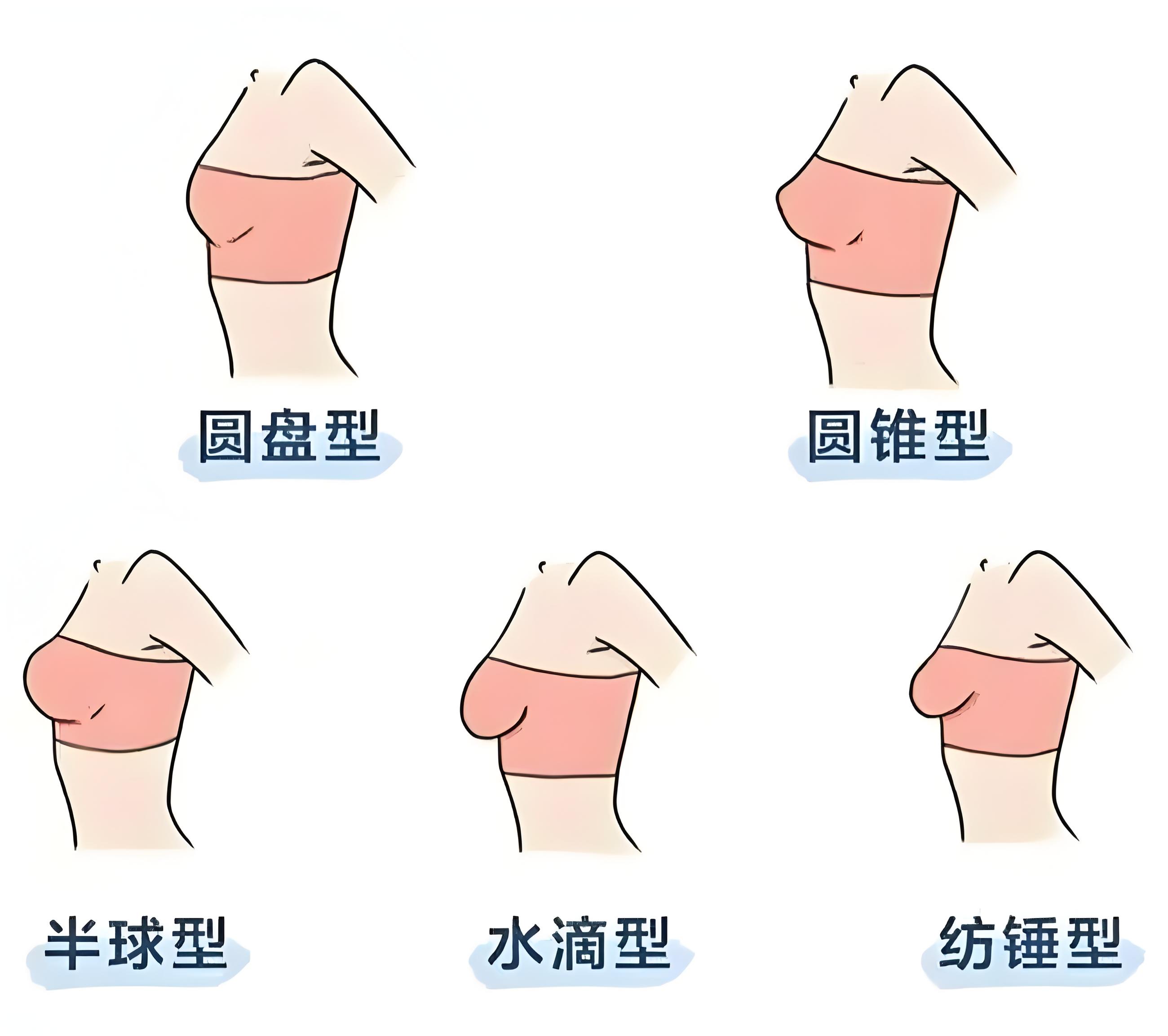 女人胸部的样子